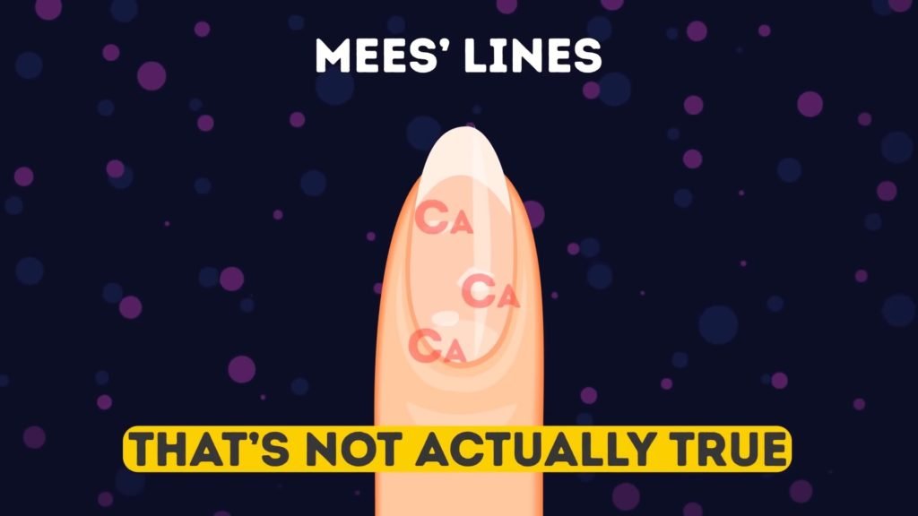 Mees lines